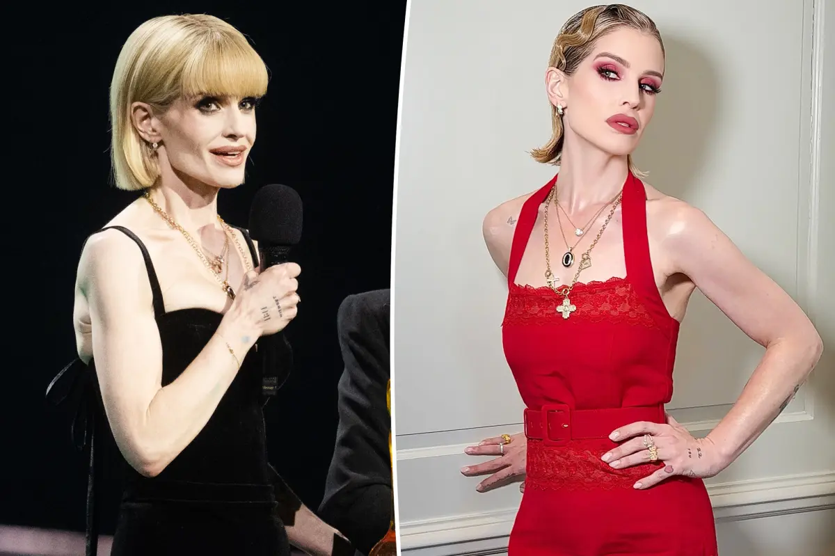 Kelly Osbourne Details ‘Slow Process’ of Recovery and Addresses Body-Shaming Comments: ‘I Wasn’t Well’