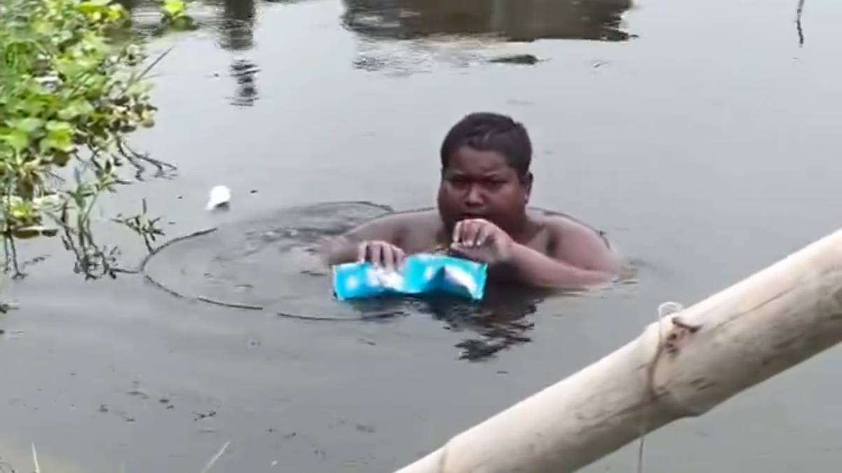 Indian Teen Who Lived in Ponds Has Rare Skin Disorder