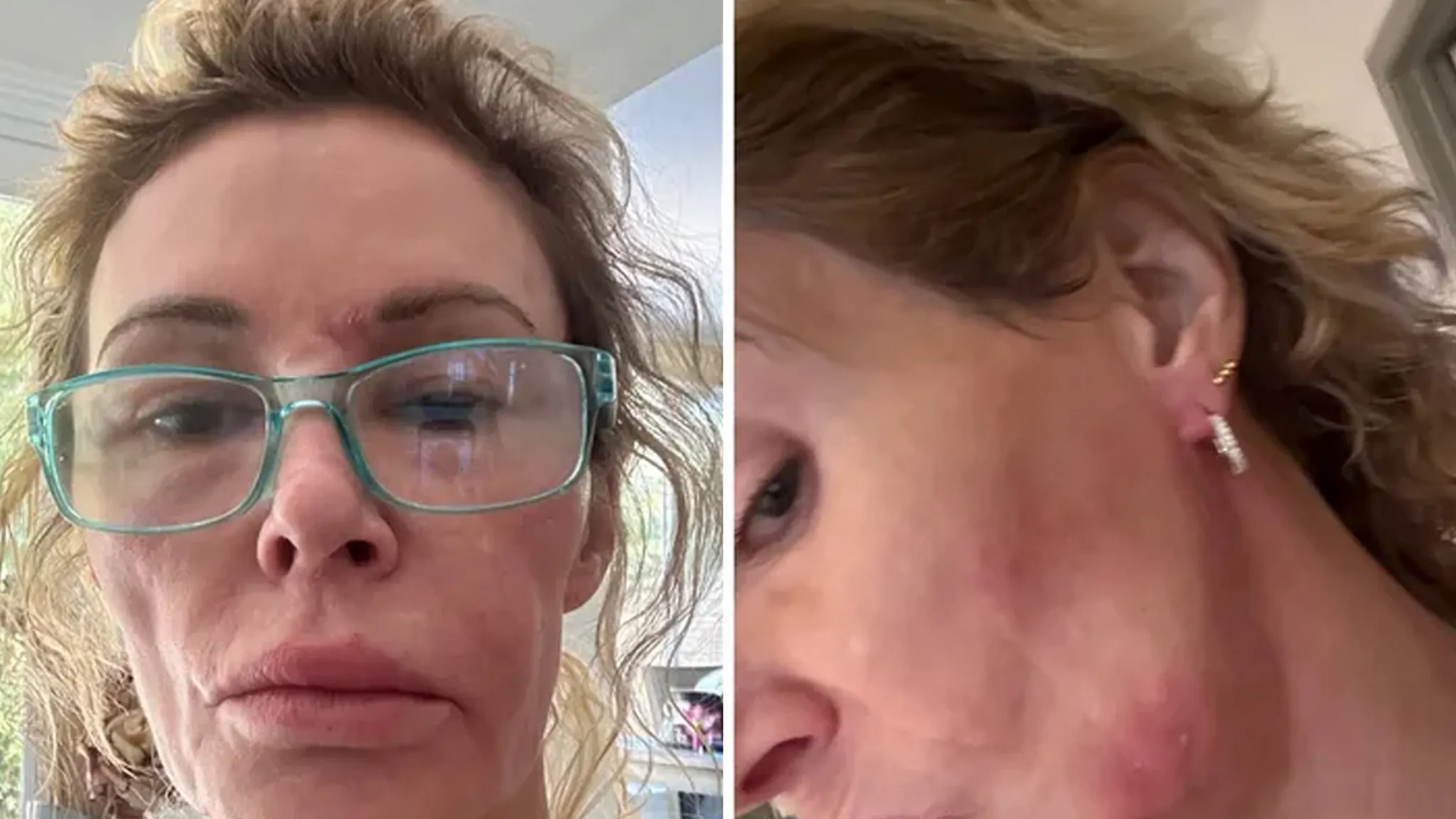 Brandi Glanville’s Friend Launches GoFundMe for Her Health Issues