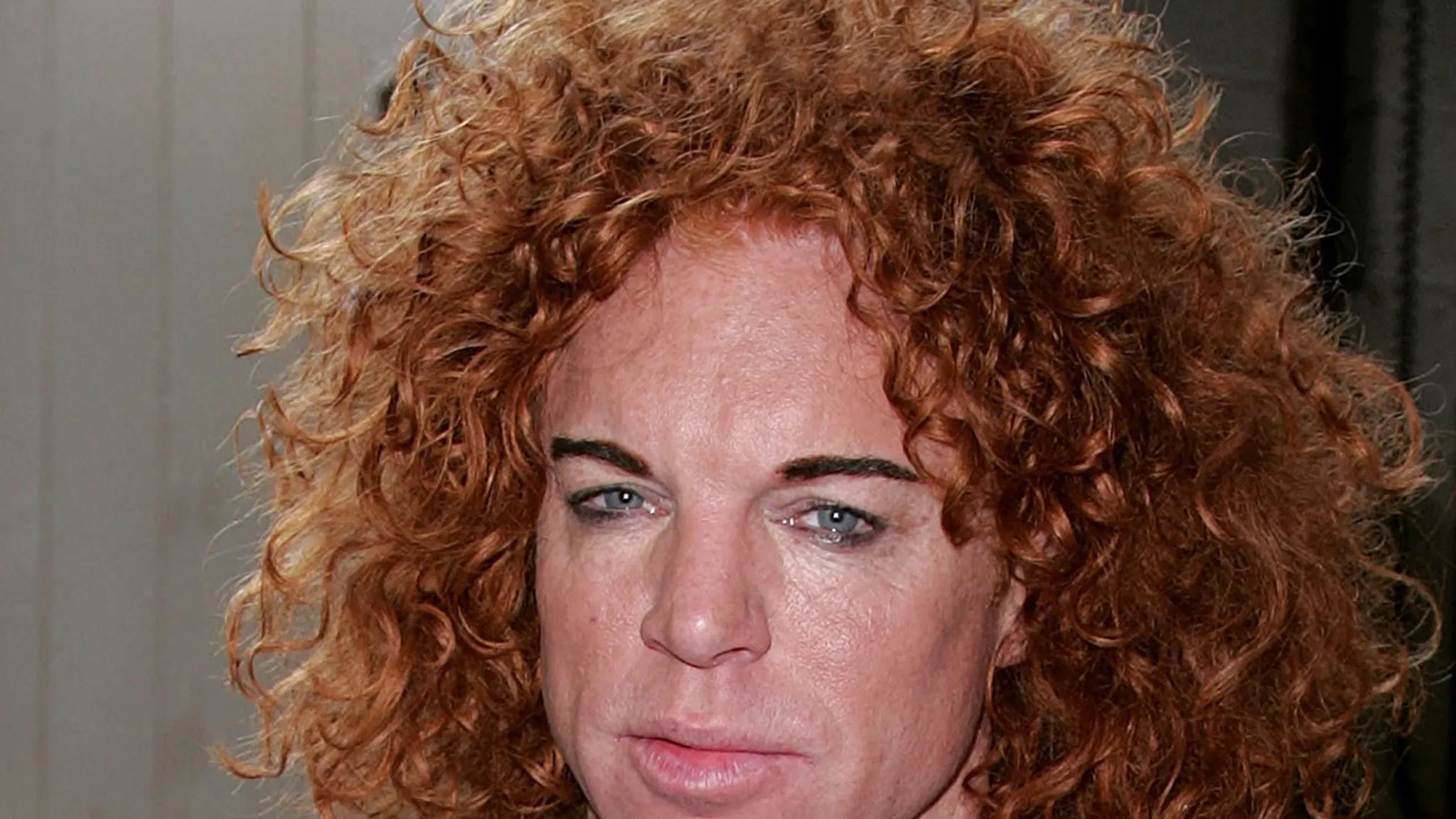 Carrot Top Released From Hospital, Reportedly Doing Better