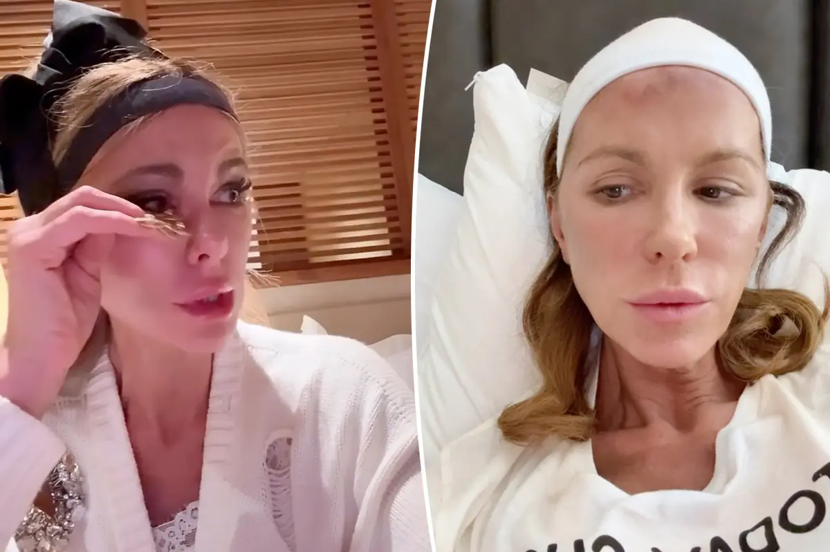 Kate Beckinsale Shares Alarming Social Media Posts Weeks After Revealing PTSD Struggles