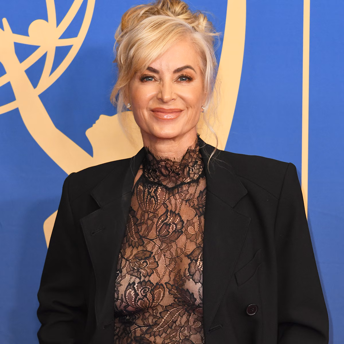 RHOBH Alum Eileen Davidson Fractures Knee in Cold Plunge Accident