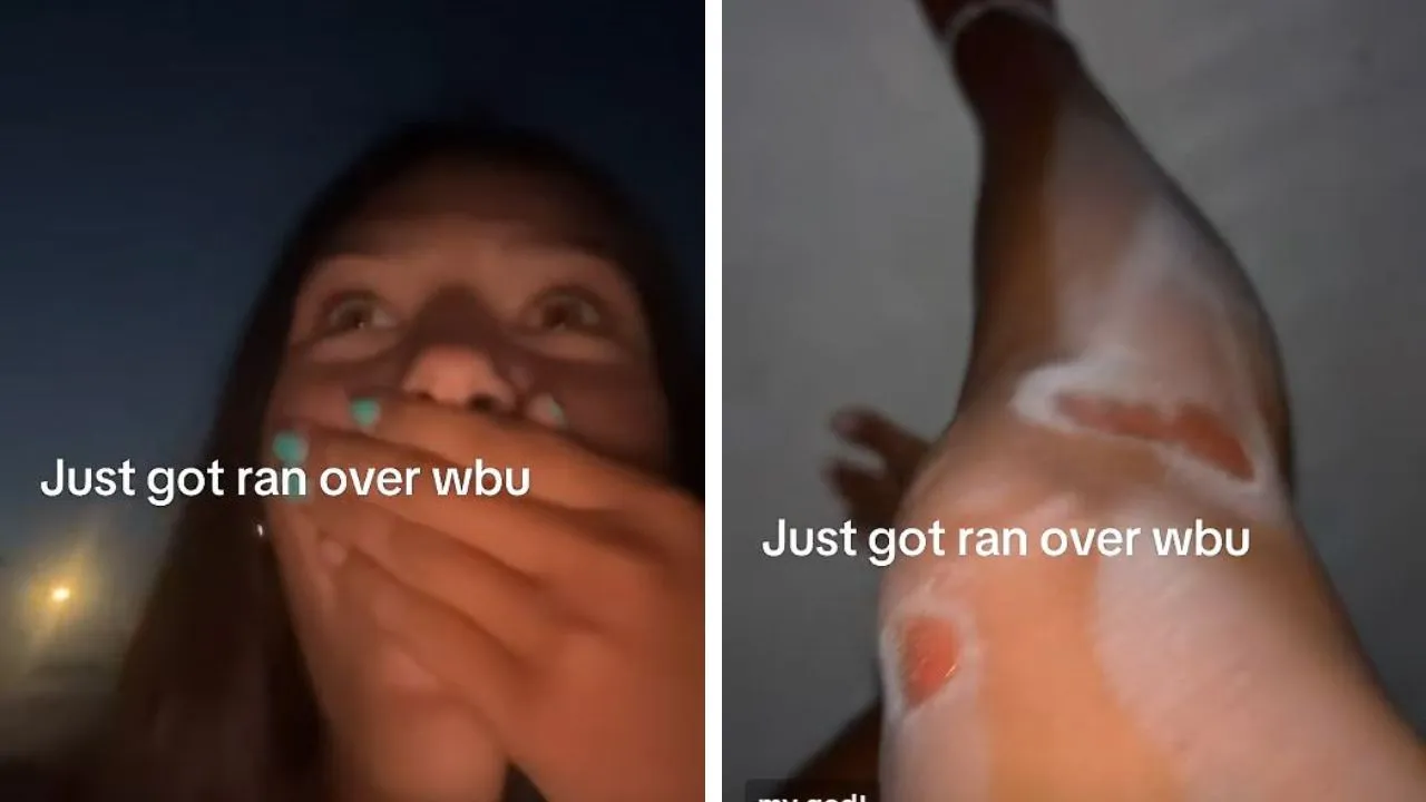 ‘Why Are You Not Crying?’ Woman’s Calm Reaction After Being Hit by Car Sparks TikTok Debate