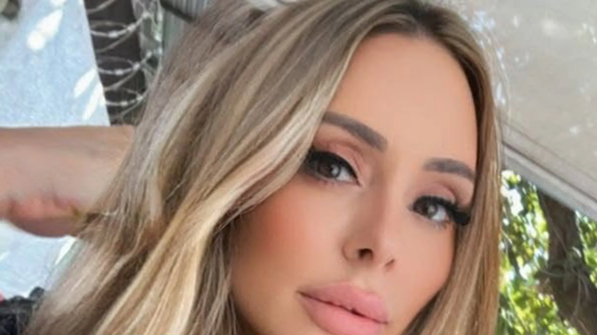 Woman Dead After Undergoing 6 Cosmetic Procedures at Once